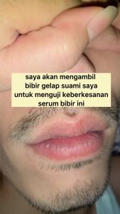 MELAO VITAMIN C SERUM BARU PINKY LIPSS