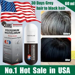 【Hot in USA】Black Hair Growth Essence Nourishing White Hair to Black Hair Activate Hair Follicle Intensive Repair Cover Grey Hair 白发变黑 60ml