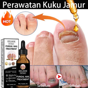 serum kuku perawatan kuku serum kuku jamur dan rusak jamur kuku nail care serum kuku rusak