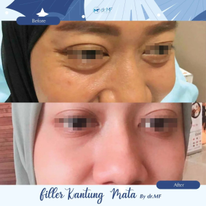 Eye cream untuk kantung mata 30g Krim mata panda dan keriput Mata bengkak 24K gold eye cream