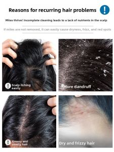 Algn | Anti-Dandruff Oil Control Shampoo Set