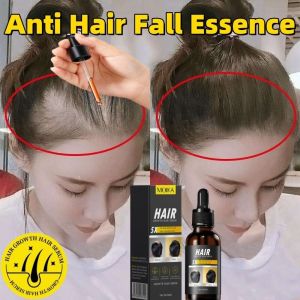 hair growth serum hair growth tonic anti hair loss serum pertumbuhan rambut 30ml Herbal extract