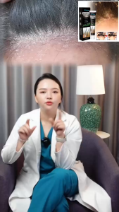 Kem Bôi Viêm Da Tiết Bã Sumifun Seborrheic Dermatitis Cream Giảm Ngứa Đỏ Gàu Da Đầu 20G Dành Cho Các Bạn