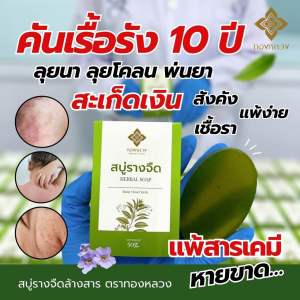 📌คันเรื้อรัง 10 ปี ล้างสารด้วย สบู่รางจืด ตราทองหลวง🌱