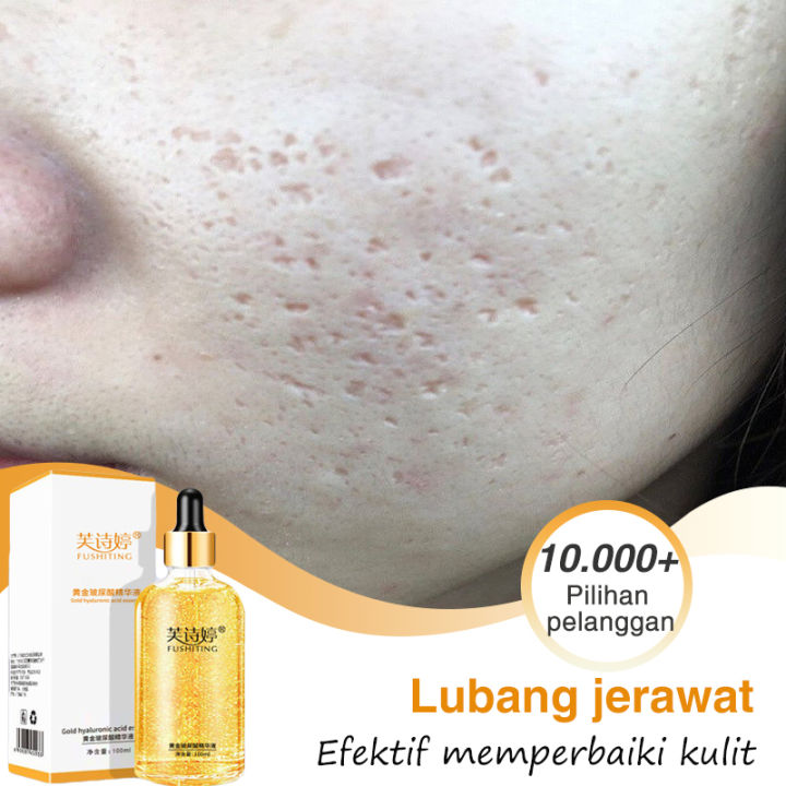 Serum Wajah 24K Facial Essence Moisturizing Penghilang Jerawat Dan ...