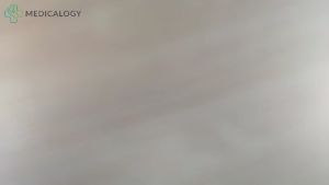 Onemed Thermo One Alpha 3 Termometer Digital Alat Penguku Suhu Badan