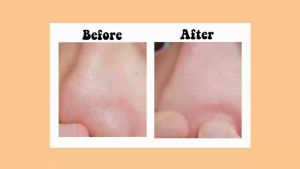 All In One Deep Cleansing Balm Tea Tree Oil /Sakura/ Lemon Extract