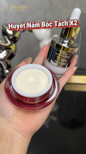 [MẪU MỚI không TẶNG SERUM] Kem Nám dưỡng da xóa tan nám tàn nhang đồi mồi Queenie skin Huyết nám bóc tách x2