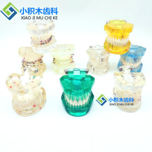 โมเดลการศึกษาช่องปาก โมเดลฟันเทียม โมเดลฟัน โมเดลการปรับแต่งข้อเข้ากันของฟัน โมเดลการรักษาทางช่องปาก กล่องของขวัญเครื่องมือดูแลช่องปาก