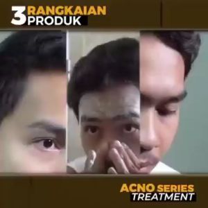 Clorismen Acno Exterminate Gel Perawatan Wajah Pria Penghilang Acne Jerawat dan Bekas Jerawat Cloris Men Pria Skincare Acno Original Clorismen Cream Serum Sc Max Brightening Pembersih Cuci Muka Wajah Pria Kusam Jerawat Bopeng Kulit Berminyak Ori BPOM