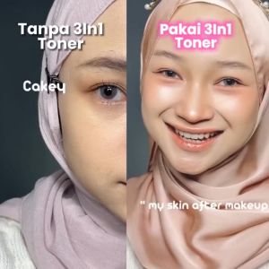 FOCALSKIN 3 IN 1 Brightening Serum Toner 100ml | Niacinamide Glowing Eksfoliasi Wajah Hydrating Aman untuk Kulit Sensitif