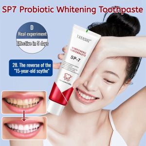 SP7 Probiotic Toothpaste Periodontal Health Nourish Oral Cleaning Care Bright White Oral Fluoride Toothpaste