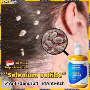 👒SG stock👒 Selenium sulfide shampoo / Anti dandruff shampoo / Psoriasis anti fungal shampoo / Dandruff scalp treatment / 头皮屑洗发水 / 二硫化硒洗发水