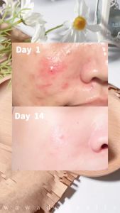 SKINTIFIC Niacinamide Brightening Serum Whitening Glowing Skin Skincare Vitamin C Serum 20ML