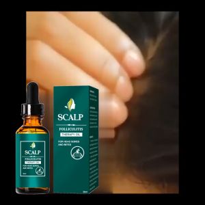 EELHOE 30ml Minyak Pengkondisi & Pembersih Kulit Kepala