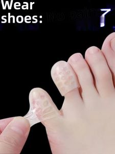 ซิลิโคนป้องกันนิ้วเท้าป้องกันการสึกหรอ ระบายอากาศได้ดี กันน้ํา Sweatproof สําหรับ Little Toes Finger Protection รองเท้าอุปกรณ์เสริม