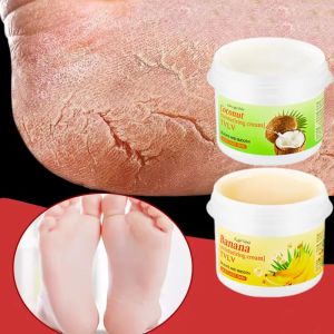 Herbal Anti Crack Foot Cream Heel Cracking Repair Products Exfoliation Dead Skin Removal Softening Moisturize Smooth Skin Care2026