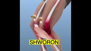 【BUY 1 TAKE 1】South Moon Bee Venom Cream Professional Treatment Gel For Legs Hands Arms Feet Pain Relief Cream Arthritis Joint Knee Analgesic Ointment Neck Lumbar Sciatica Synovial Meniscus Repair Bone Therapy Cream 30g