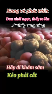 Kem Thoa Làm Dịu Vùng Tuyến Vú Chiết Xuất Thảo Mộc Thiên Nhiên Dưỡng Da Êm Dịu Hộp 50g Dành Cho Các Chị Em