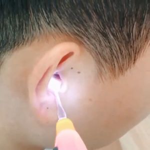 Dụng Cụ Lấy Ráy Tai Có Đèn Đầu Mềm An Toàn Cho Bé - Lấy ráy tai có đèn 3 đầu