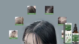 OUHOE Rosemary Oil For Hair And Scalp Support Healthy‑Looking Hair Nourishing Scalp Strengthening Hair Repair Damaged Frizzy Thinning Hair 50ml