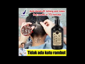 Sampo Kutu Dewasa&Anak-anak / Shampo Penghilang Kutu / Sampo Atasi Ketombe / Sampo Gatal Anti Ketombe / folikulitis/ Shampo Wangi / Sampo Pengharum / Shampo Anti Kutu&Rontok 100% Sampo Paling Ampuh 300ml