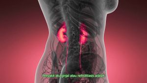 Vellare Bharata Obat Batu Empedu Batu Ginjal Kencing Batu Tanpa Operasi Paling Ampuh 100% Original