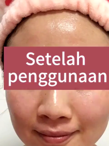 SADOER Freckle Cream Krim Wajah Penghilang Flek Hitam Glowing Memutihkan dan Mencerahkan Kulit SR098