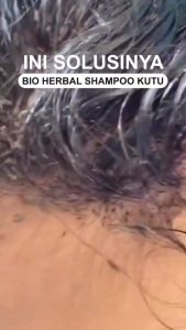 Shampo Anti Kutu dan Telur Kutu Anak Paling Ampuh BPOM Shirami Shampoo Anti Kutu