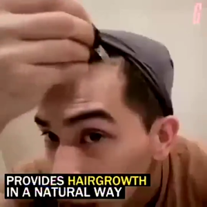 Hair Growth Serum Oil Anti Hair Loss Treatment Polygonum Multiflorum Essence Thick Hair Regrowth For Men Women Balding Thinning Hairline Receding Stress Hair Fall Scalp Care Natural Herbal Ginger Ginseng Angelica Black Sesame Seeds Prevent Baldness Stop