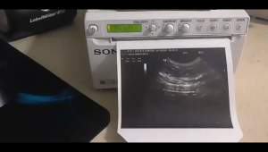 110mmx18m Kertas Usg/Kertas Usg Upp 110s/Kertas Thermal/ Printer Sony