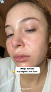 SKINEVER 3A Retinol Anti-Aging Cream Firming Moisturizer Fades Fine Lines & Wrinkles Collagen Care