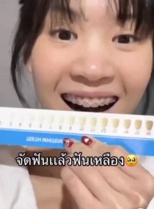 🌸โปร 1 แถม 1 🌸 FEISIDELIN ขนาด 100 กรัม ลดกลิ่นปาก ช่วยให้ลมหายใจสดชื่น หอมยาวนาน 12 ชั่วโมง. เฟยซิเดลิน ยาสีฟัน กลิ่นเชอร์รี่บลอสซั่มพีช กลูคาเนส ไวท์เทนนิ่ง  ยาสีฟันหลอดนี้จบทุกปัญหาช่องปาก