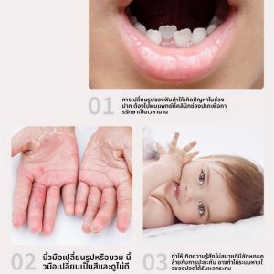 เครื่องปรับแต่งเล็บสวมใส่สำหรับผู้ใหญ่ แผ่นป้องกันการกัดเล็บ ช่วยเสริมสร้างความแข็งแรงให้กับเล็บ สำหรับนักเรียนและผู้ชาย