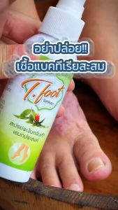 T.Foot Spray สเปรย์ระงับกลิ่นเท้าเอนกประสงค์ ระงับกลิ่นอับ 129 บาท (ขนาด 100 มล.)