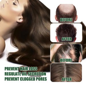 Hot original rosemary hair tonic growth serum anti hair loss plant herb hair carepenumbuh rambut60ml頭發精油防脱育发迷迭香
