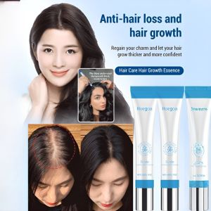 Roller Massage Scalp Essence: A Comprehensive Guide