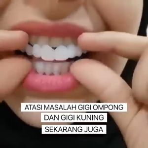 Snap On Smile Gigi Palsu Atas Bawah Perapi Gigi Veneer Gigi Palsu Snap On Smile Gigi Palsu Atas Bawah Veneer Gigi Palsu Atas Bawah Gigi Palsu Snap On Smile  Veener Gigi Snap On Smile Perawatan Gigi