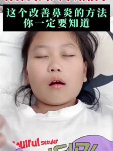 鼻炎贴可缓解变应性鼻炎和鼻窦炎Dr. Wus rhinitis patch relieves allergic rhinitis and sinusitis improves hypertrophic inferior turbinates and unblocks the nasal cavity.