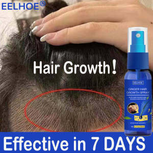 EELHOE Hair Growth Spray Penumbuh Rambut Botak Serum Clothes of Skin 7 Days Ginger Germinal Oil Minyak Penumbuh dan Perawatan Rambut Hair Care 30ML-💖Uiabgt