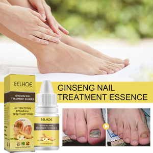 A.one EELHOE Nail Repair Essence Serum Fungal Nail Treatment Improve Grey Nail Fungal Treatment Anti Fungal Nail Solution Hand Foot Skin Care 10ml