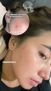 TERBARU Taboya Number 17 Serum 20ml Mencerahkan Kulit Wajah sepanjang hari