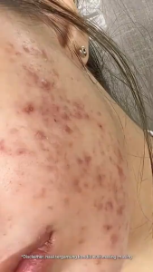 HANASUI Lightweight Pro Calming Sunscreen SPF 50 - Sunscreen Kulit Sensitif & Jerawat