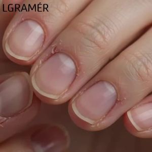6 Smells 18ml Cuticle Oil Nail Care Nutrition Nails Repair Manicure Revitalizer Oil Prevent Agnail Nail Polish Nail Treatment