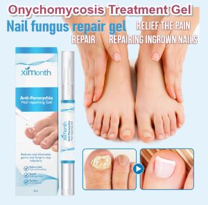 Gray nail gel for pain relief and thickening