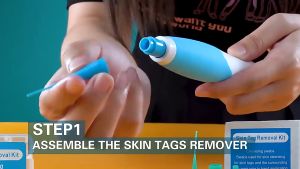 Skin Tag Remover Kit Skin Tag Removal Device Wart Removal Pen Painless Skin Tag Mole Wart Removal Kit 40x Rubber Bands+10x Alcohol Pad Body Warts Treatment Foot Corn Removal Care Tool Adult Mole Stain Wart Remover Face Care Beauty Tools