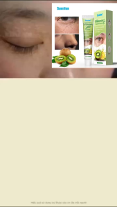 Kem Dưỡng Mắt Hỗ Trợ Làm Giảm Mụn Mắt Nhẹ Với Thành Phần Tự Nhiên Dành Riêng Cho Vùng Da Quanh Mắt Mỏng Nhẹ