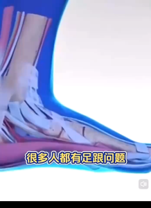 Heel Pain Patches foot pain relief patch quickly relieves foot discomfort foot strain/sprain/plantar fasciitis/tendonitis/Achilles tendonitis/heel tingling