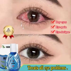 Eye drops for dry eyes eye care Eyedrops for tired eyes 15ml Eye Drops Artificial Tears Improve Eyesight Protect myopia relieve eye fatigue