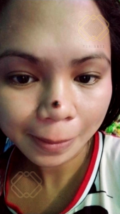 Skin Tags Mole Remover Warts Remover Cream Corn Removal 15g Antibacterial Foot Warts Hand Warts Corn